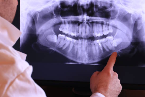 Best Cracked Tooth Emergency Dentist  in Nappanee, IN