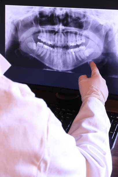 Best Knocked-Out Tooth Emergency  in Nappanee, IN